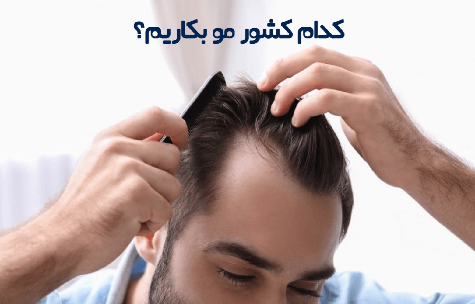 بهترین کشورها برای کاشت مو کجاست